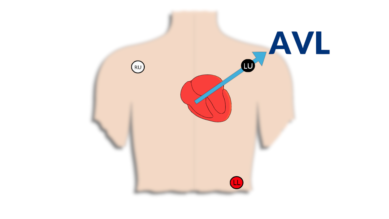 3-Lead ECG – Nursing Unraveled