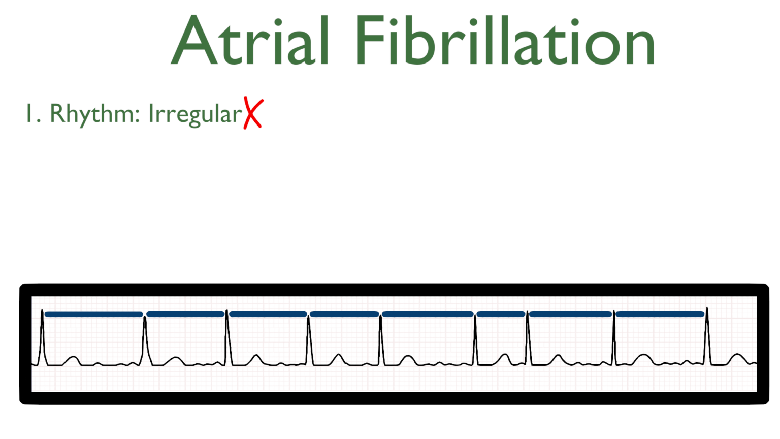 Atrial Fibrillation (AF) – Nursing Unraveled